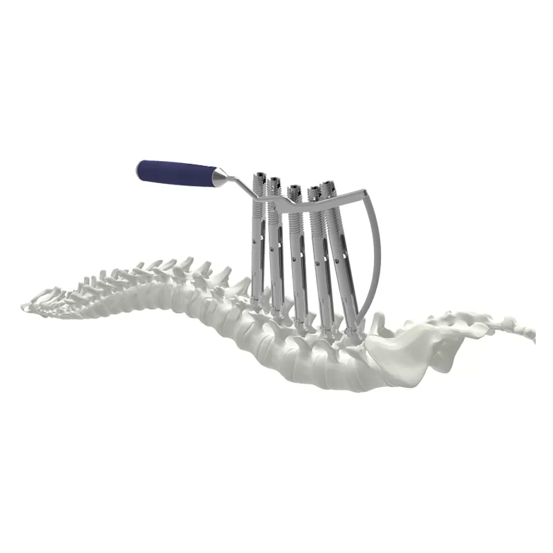 6.0 Thoracolumbar Percutaneous Minimally Invasive Screw & Rod System