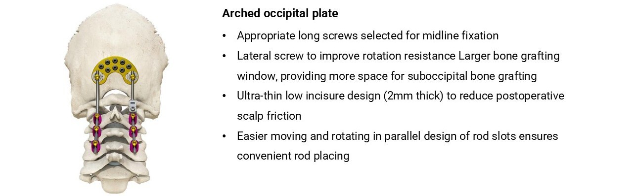 Occipital Plate - OCT System Components