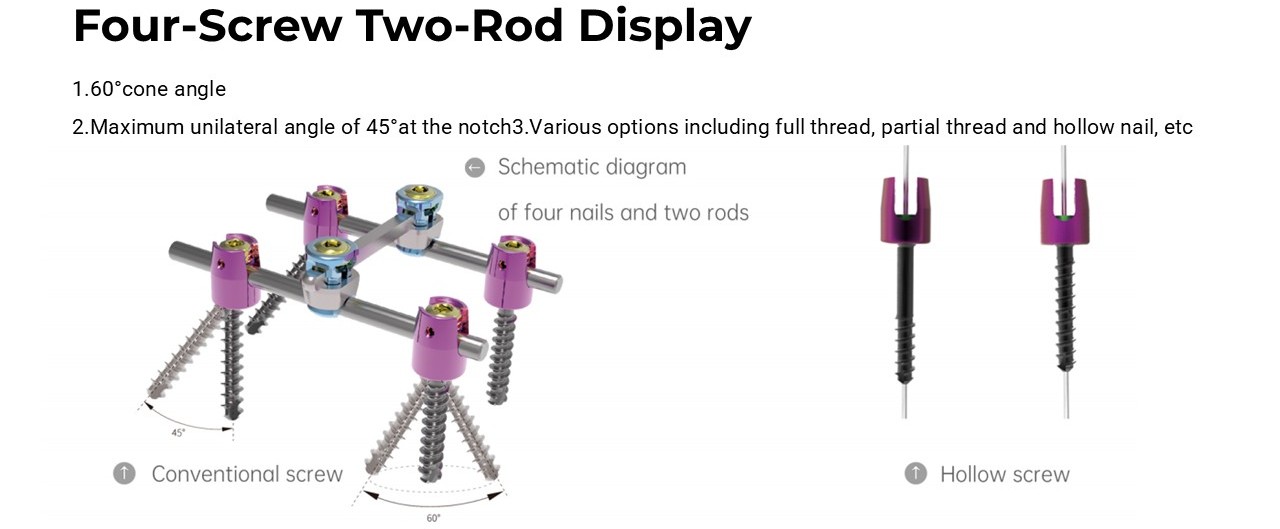 Polyaxial screwv(fully threaded) - OCT System Components