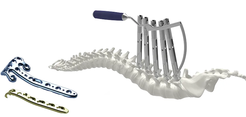Looking for a Reliable Orthopedic Implants Supplier? Looking for a Reliable Orthopedic Implants Supplier?