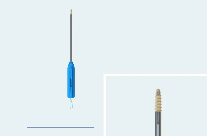 Suture Anchor Fixation for Inferior Pole Patellar Fractures