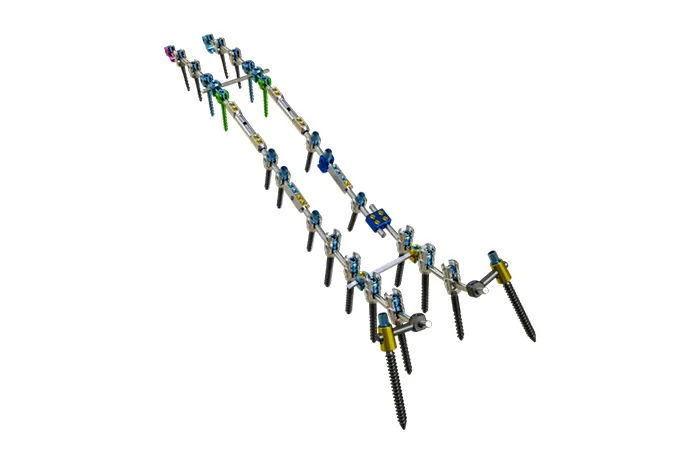 PUMC Classification and Solutions for Idiopathic Scoliosis