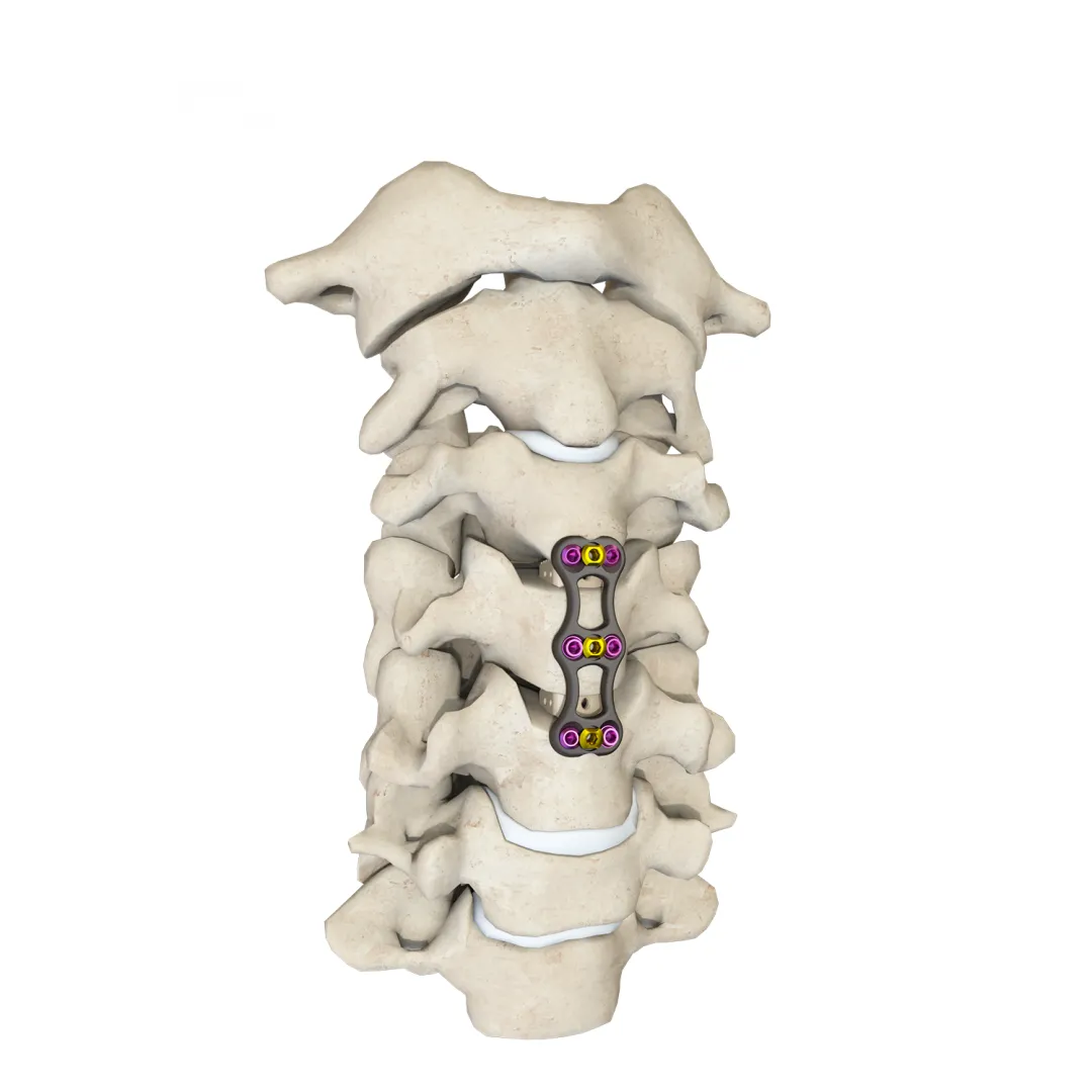 Anterior Cervical Plate Fixation System