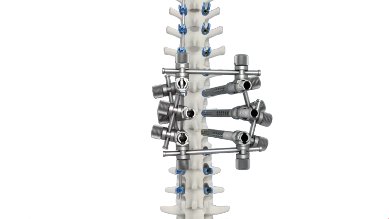 CoCrMo Thoracolumbar Posterior Screw-Rod System 6.0