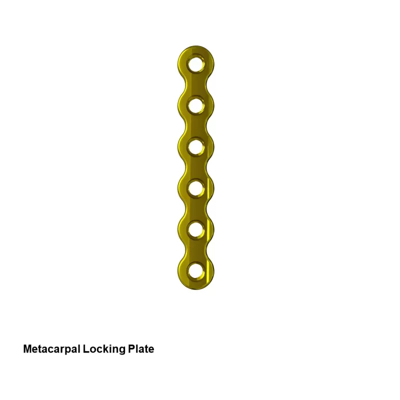 Palmar Locking Plate