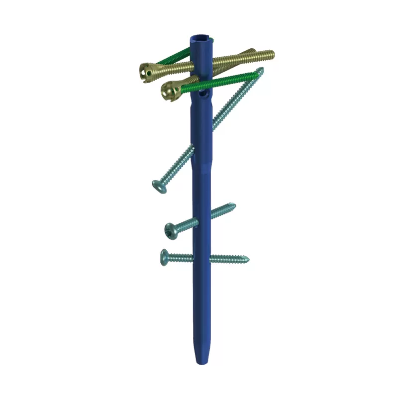 Humeral Intramedullary Nail