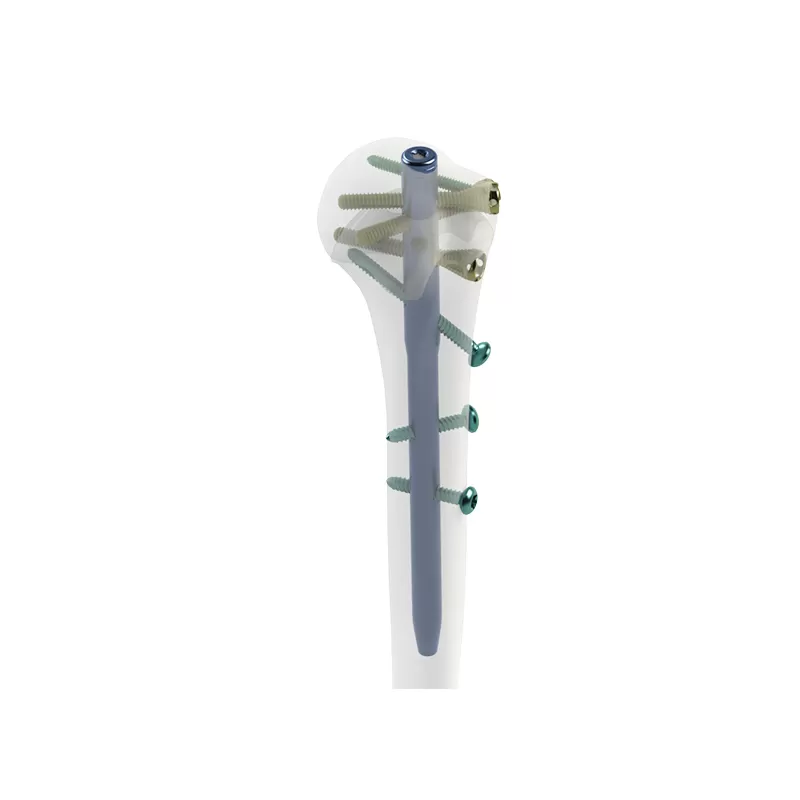 Humeral Intramedullary Nail