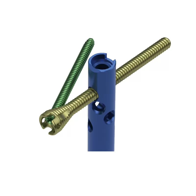 Humeral Intramedullary Nail
