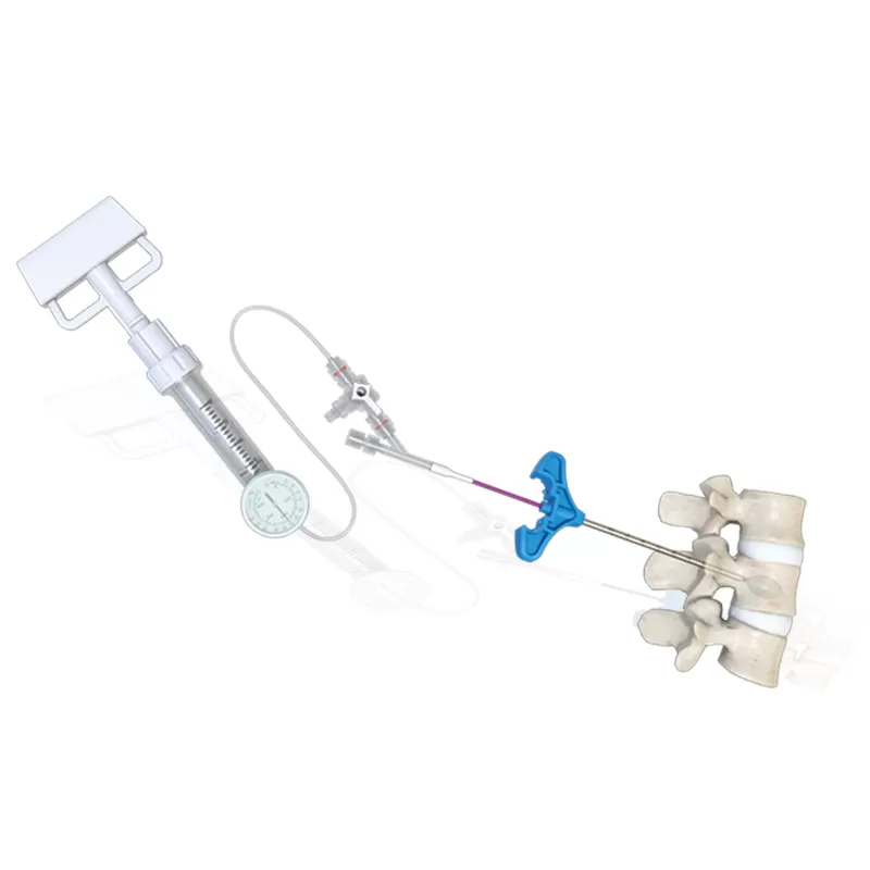Balloon Kyphoplasty (PKP)