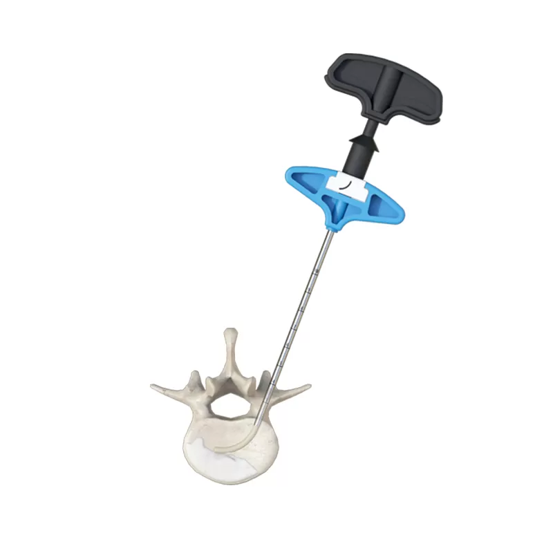 Curved Vertebroplasty (PCVP)