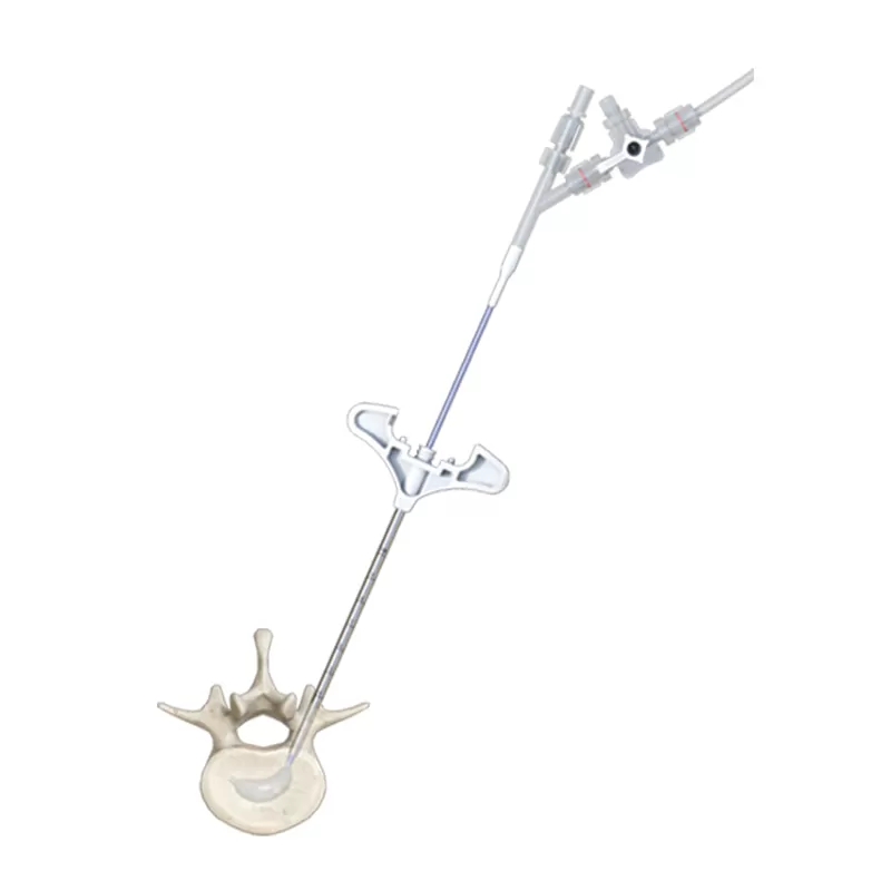 Curved Balloon Kyphoplasty (PCKP)