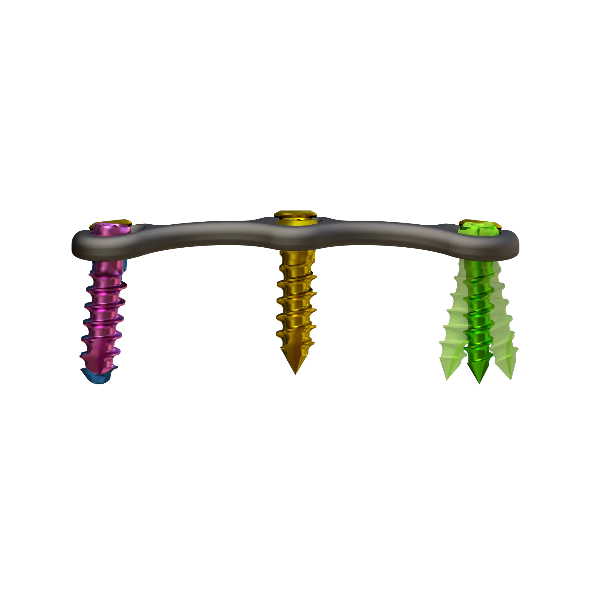 Anterior Cervical Plate - Type II