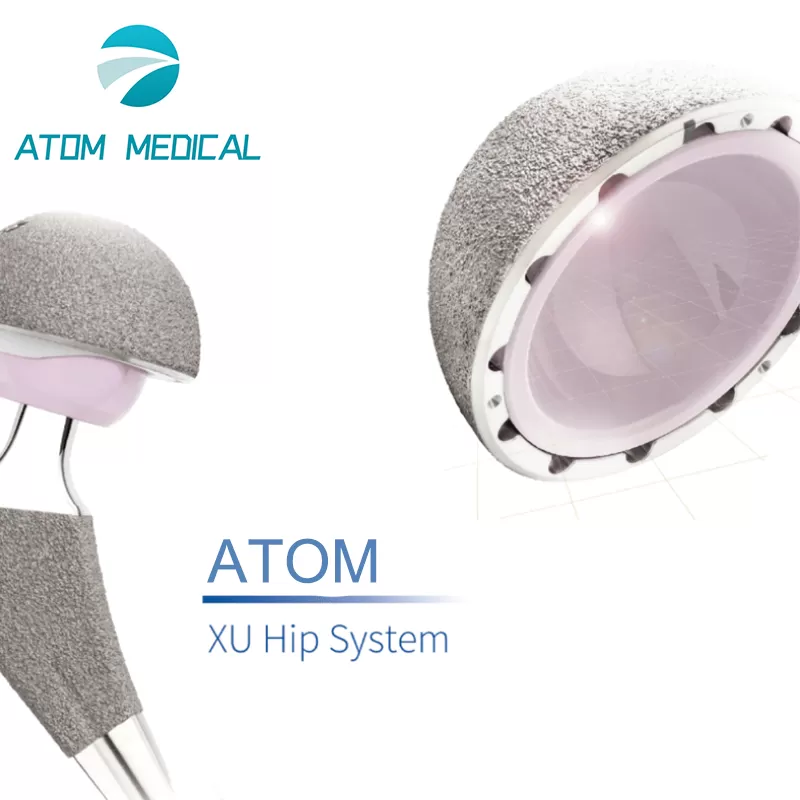 acetabular implant