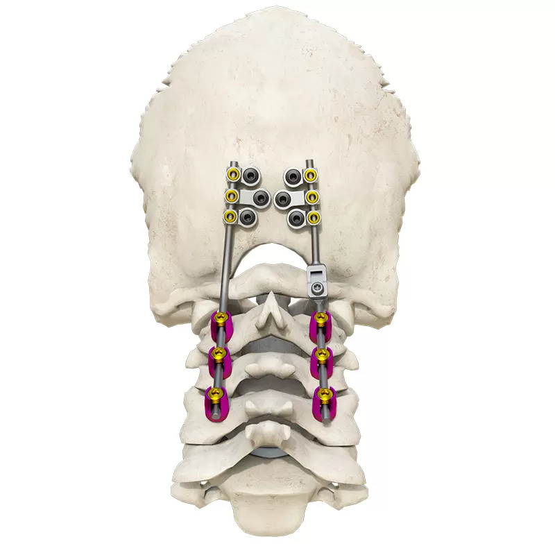 Posterior occipital-cervical-thoracic spinal system