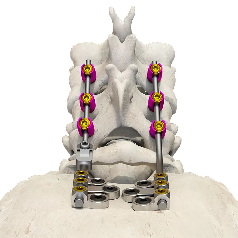 Posterior occipital-cervical-thoracic spinal system
