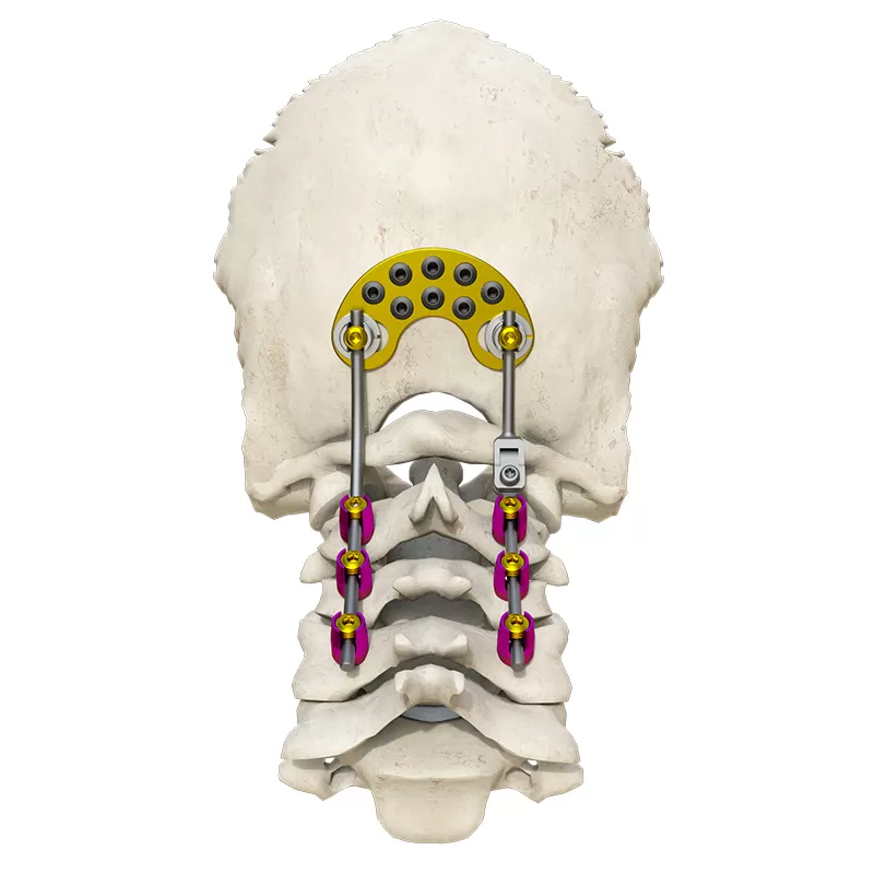 Posterior occipital-cervical-thoracic spinal system