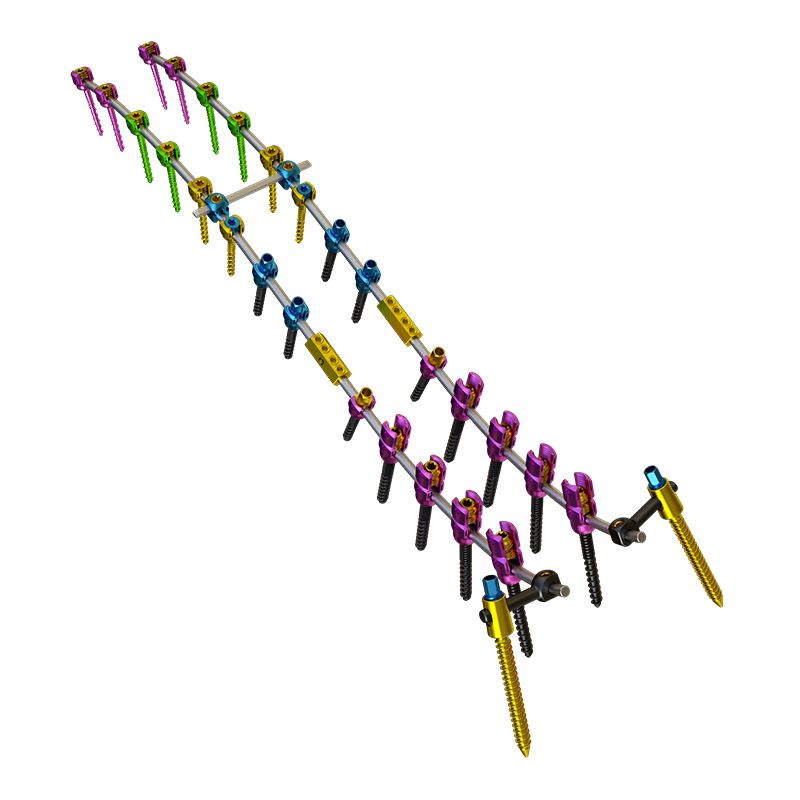 Thoracolumbar Rod System – Open