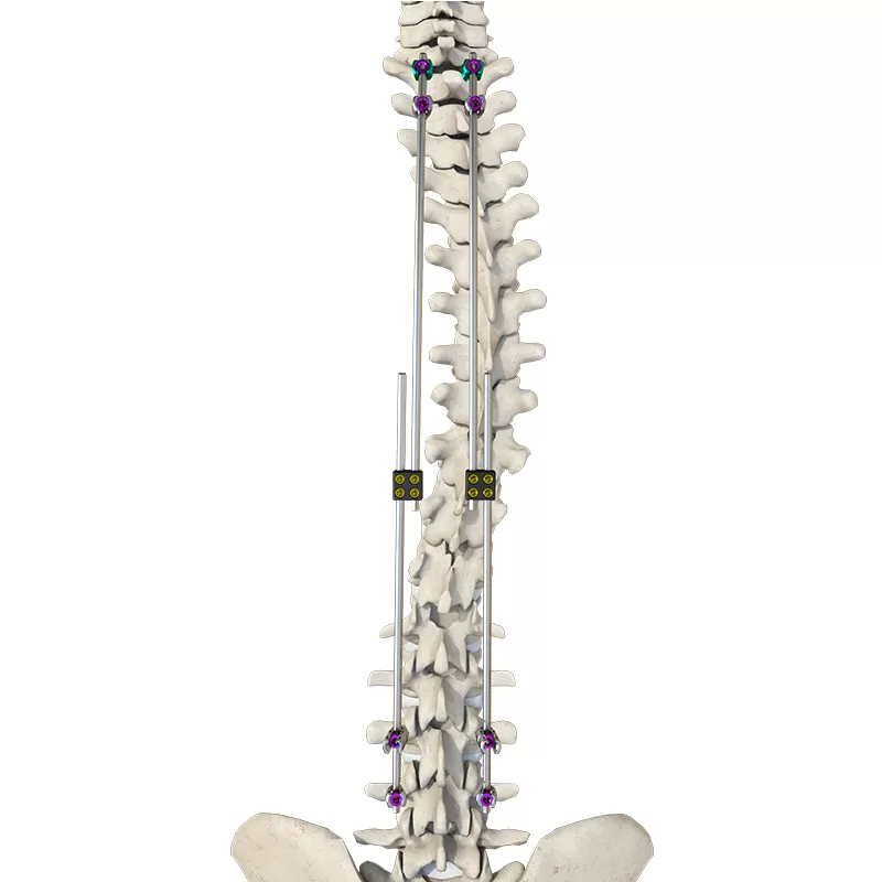 CoCrMo Posterior Thoracolumbar Spinal System 4.5(for children)