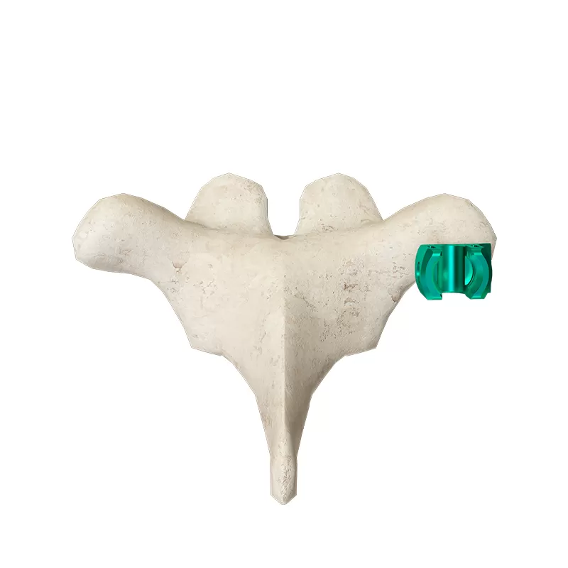 Leftward slanted hook I -M  (4.5 system)