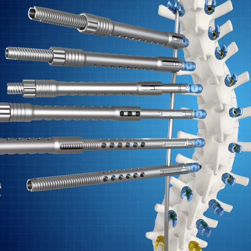 Ti Posterior Rod-Screw for Spinal Deformity (5.5 System)