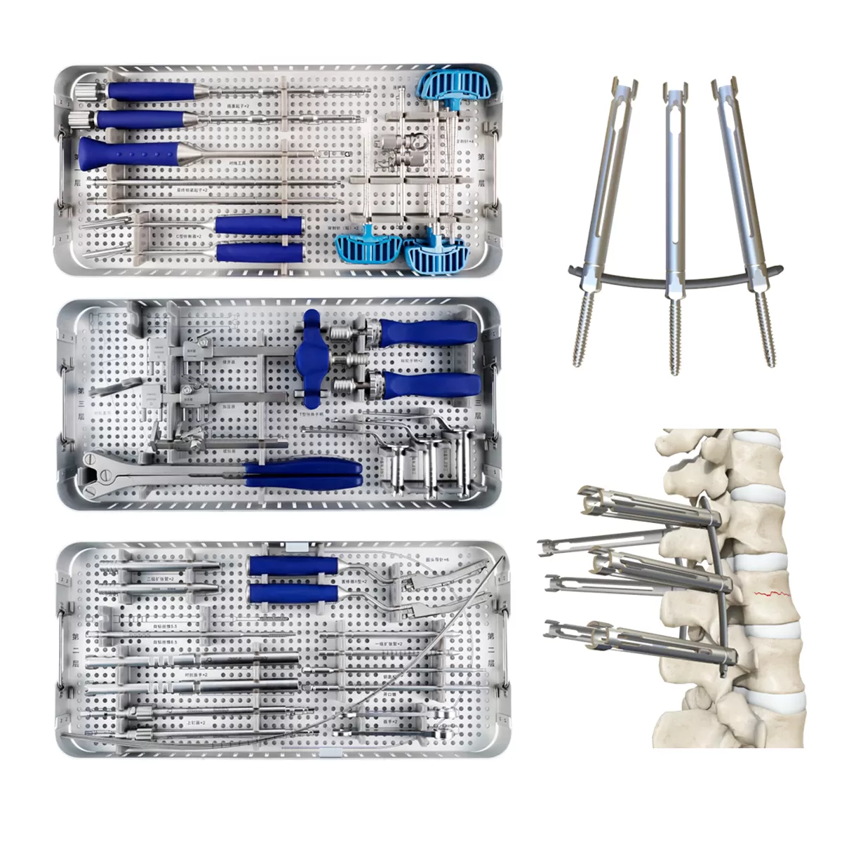 5.5mm Percutaneous MIS TL Fracturing Arm System
