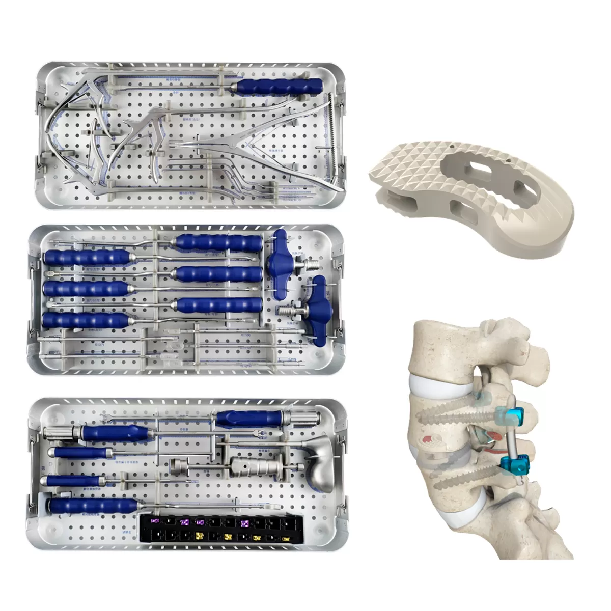 TLIF Interbody Cage Instrument Set - I