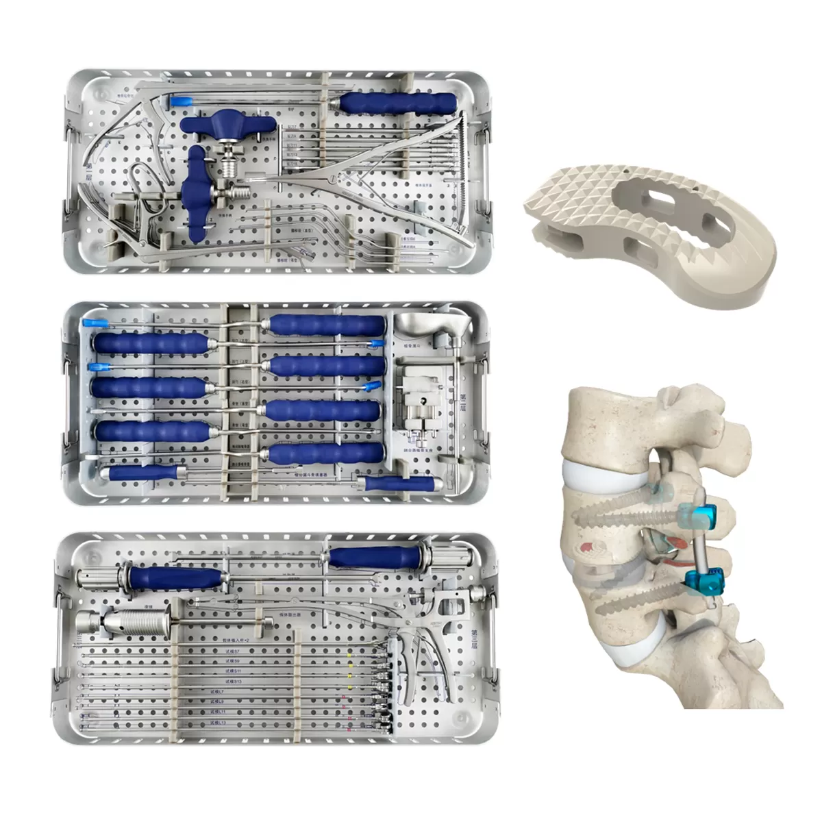 TLIF Interbody Cage Instrument Set - II