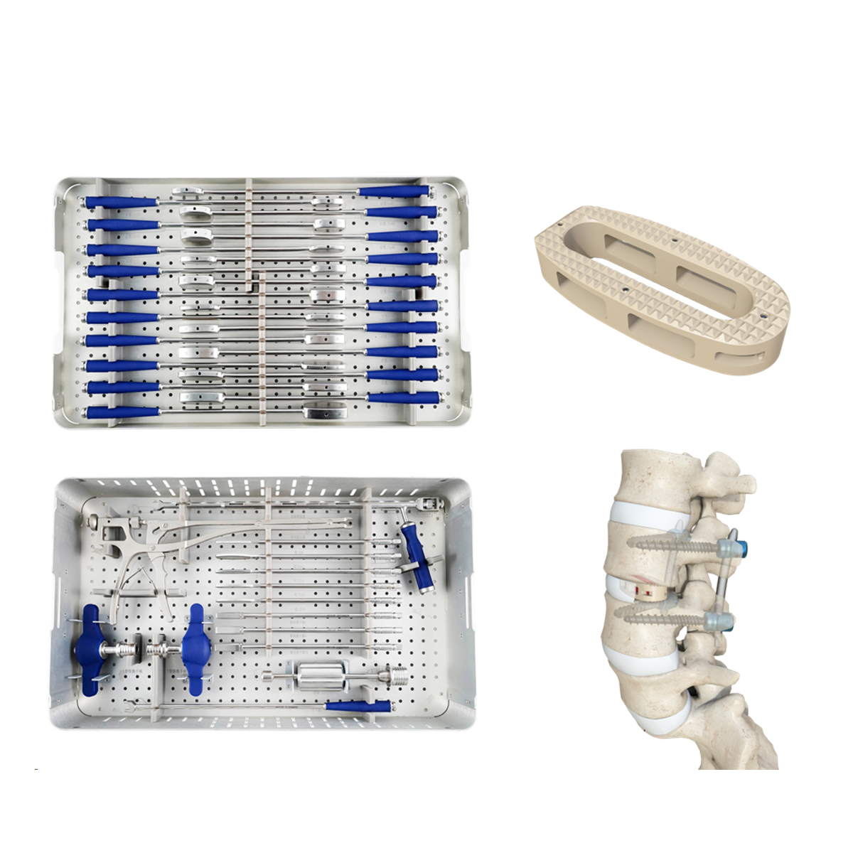 OLIF Cage Instrument Set - Disc Preparation