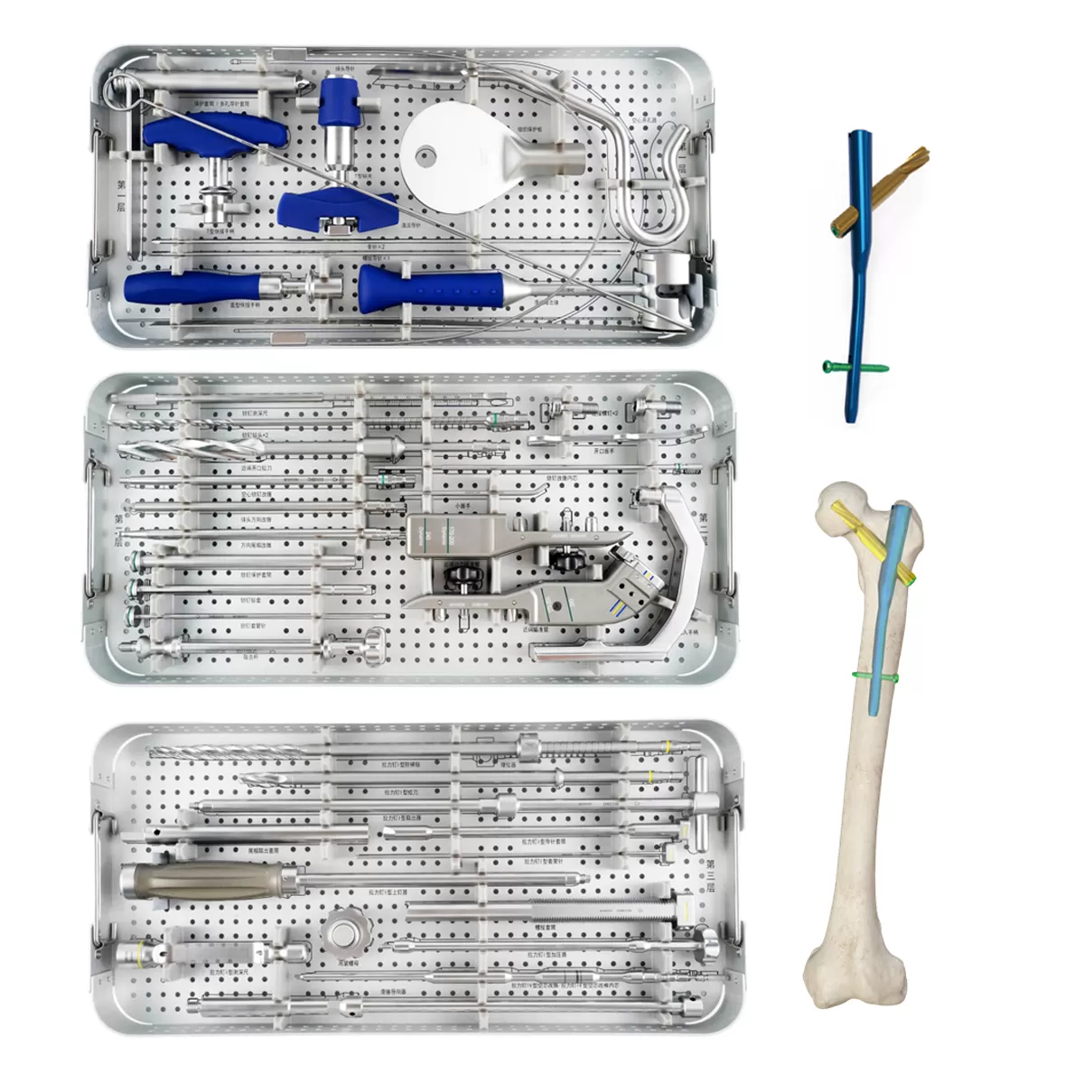 Proximal Femoral Intramedullary Nail - TYPE I (SHORT) Instrument Set