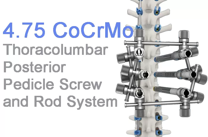 Classic Case 4.75 Systemic Treatment of Multi-Segmental Adult Thoracolumbar Degenerative Diseases