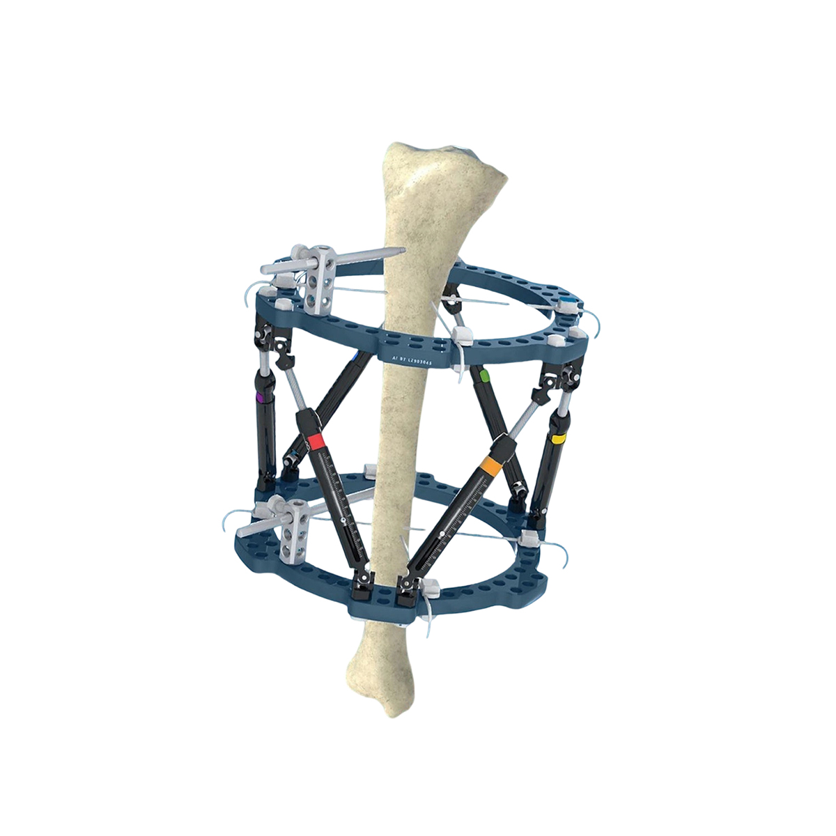 External Fixator
