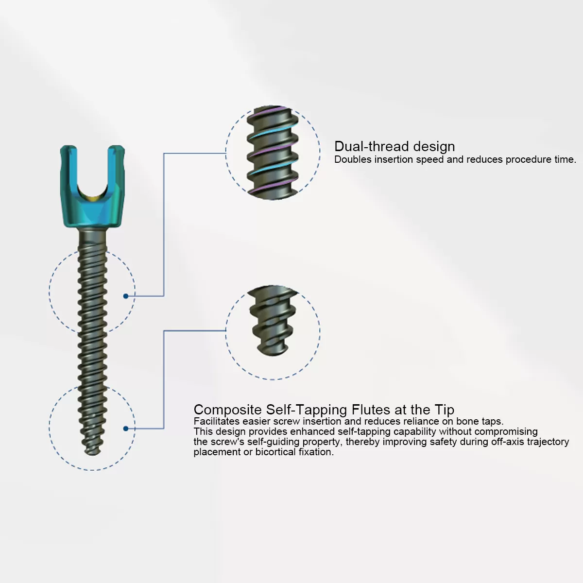 Luna Posterior Thoracolumbar Spinal System