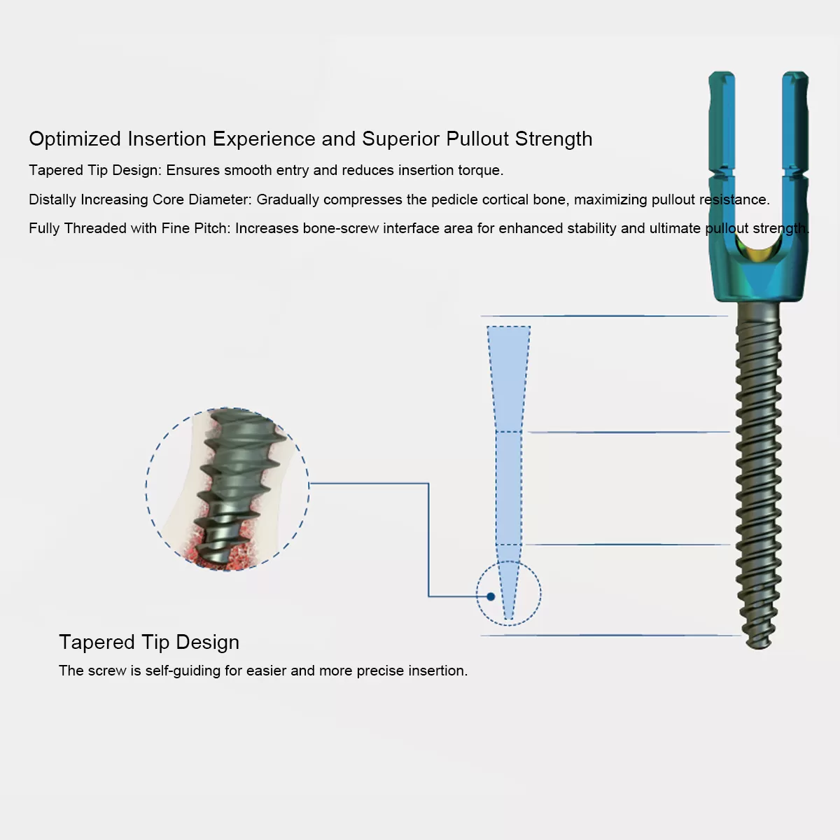 Luna Posterior Thoracolumbar Spinal System