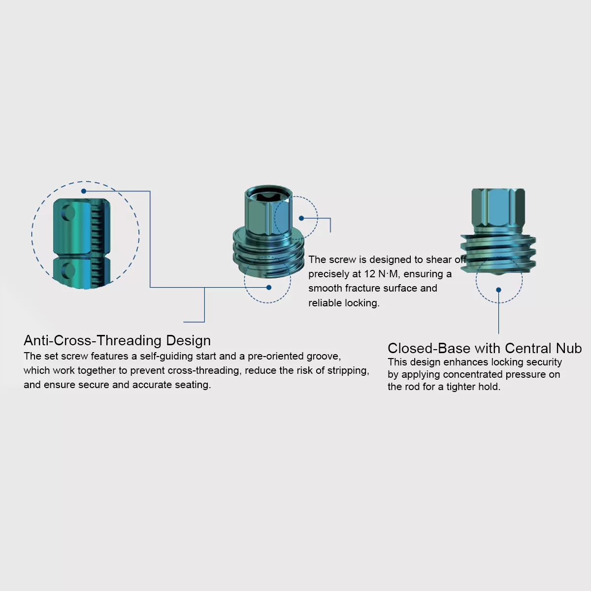 Luna Posterior Thoracolumbar Spinal System