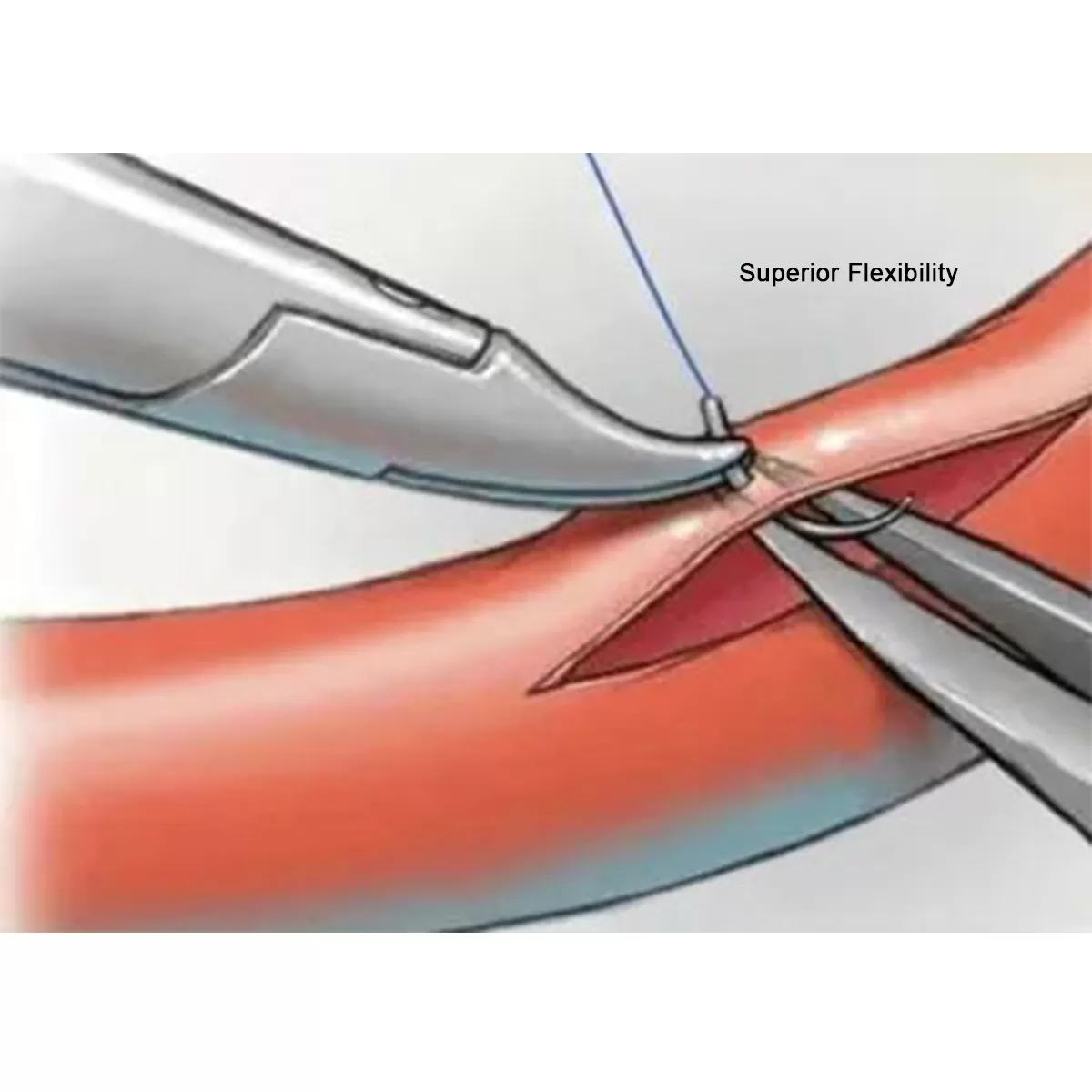 Polypropylene Suture - Blue