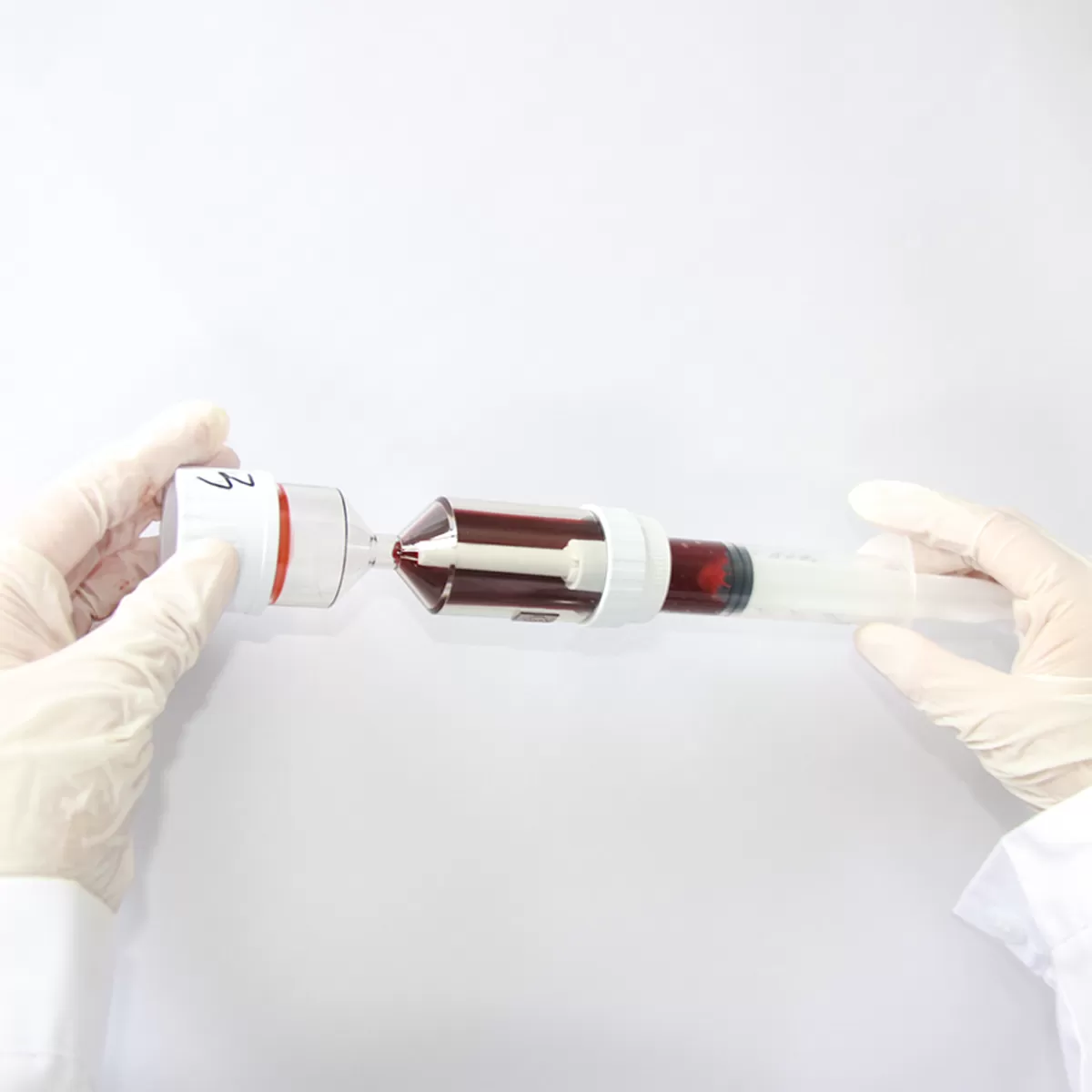 Platelet-Rich Plasma (PRP)