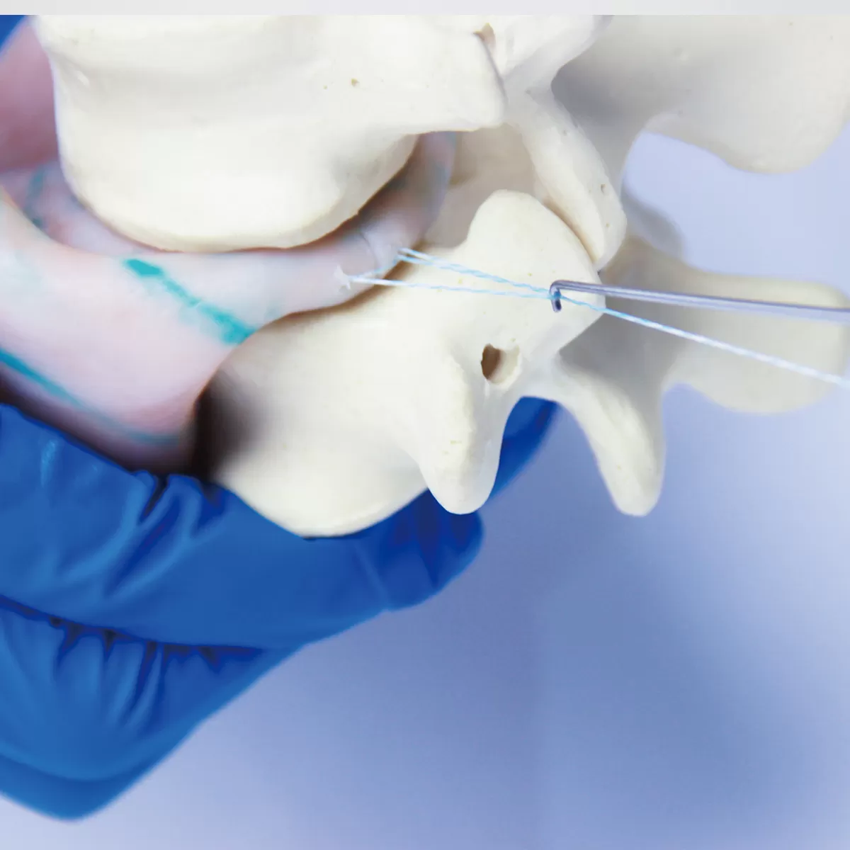 Annular Closure Device