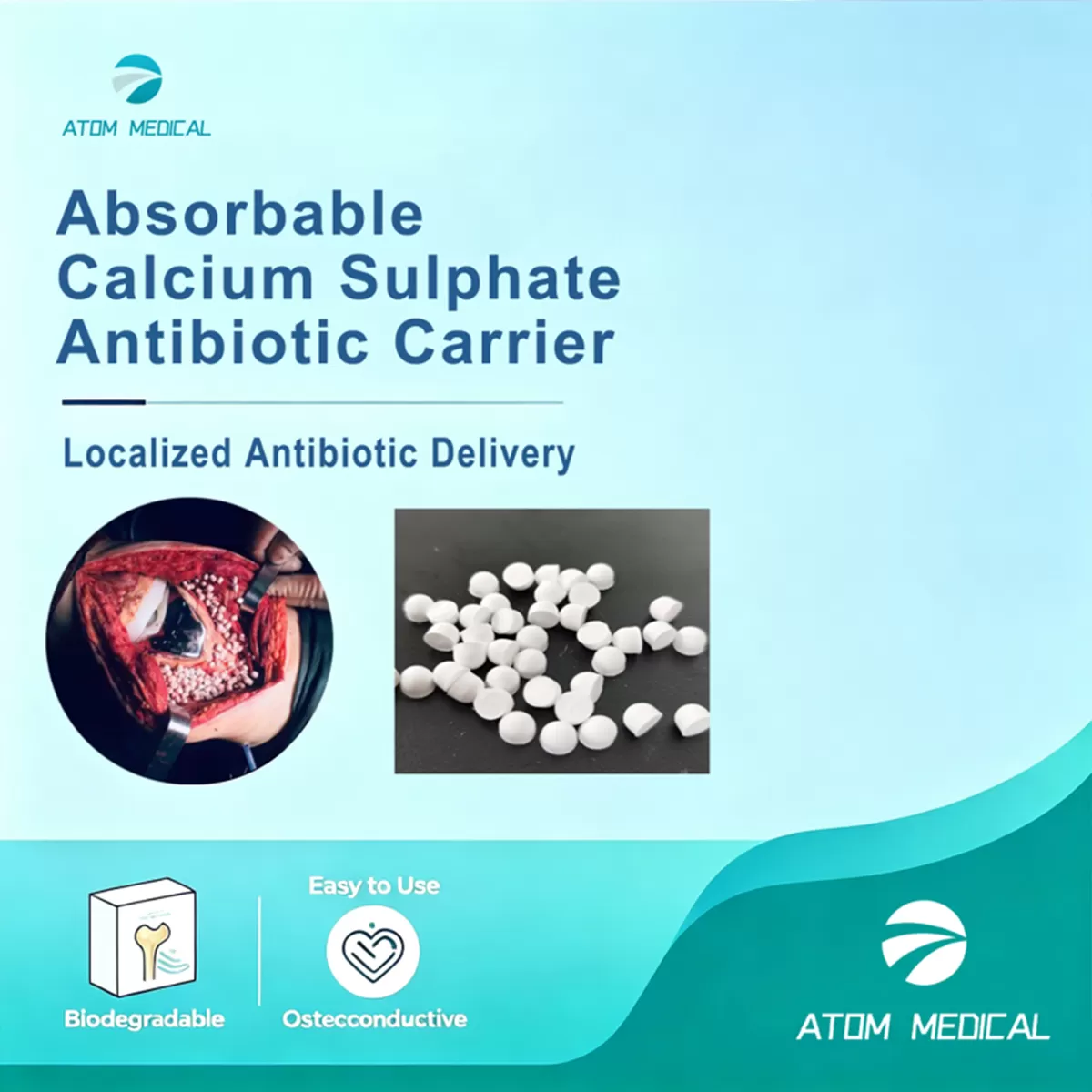 Absorbable Calcium Sulphate Antibiotic Carrier