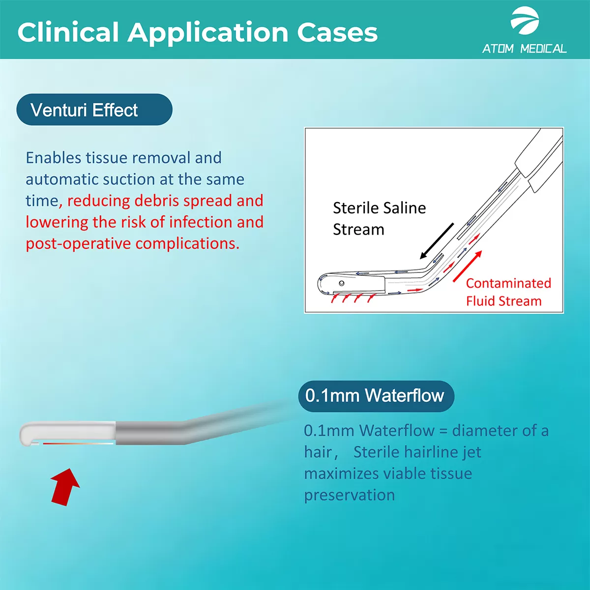 Hydrosurgery Debridement System