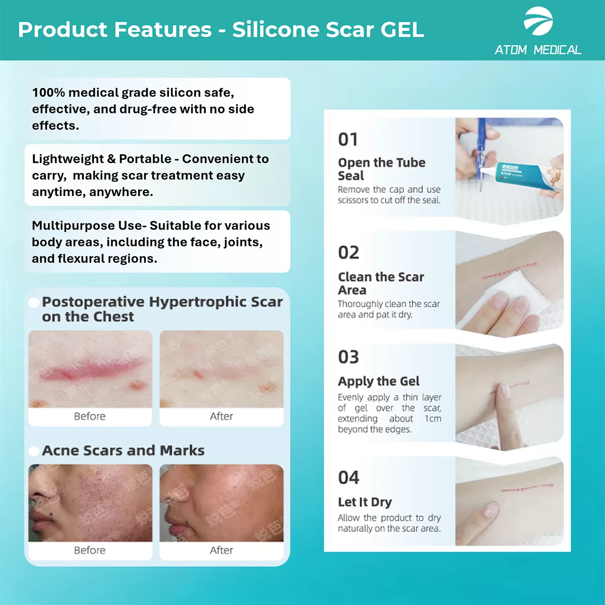 Silicone Scar Gel