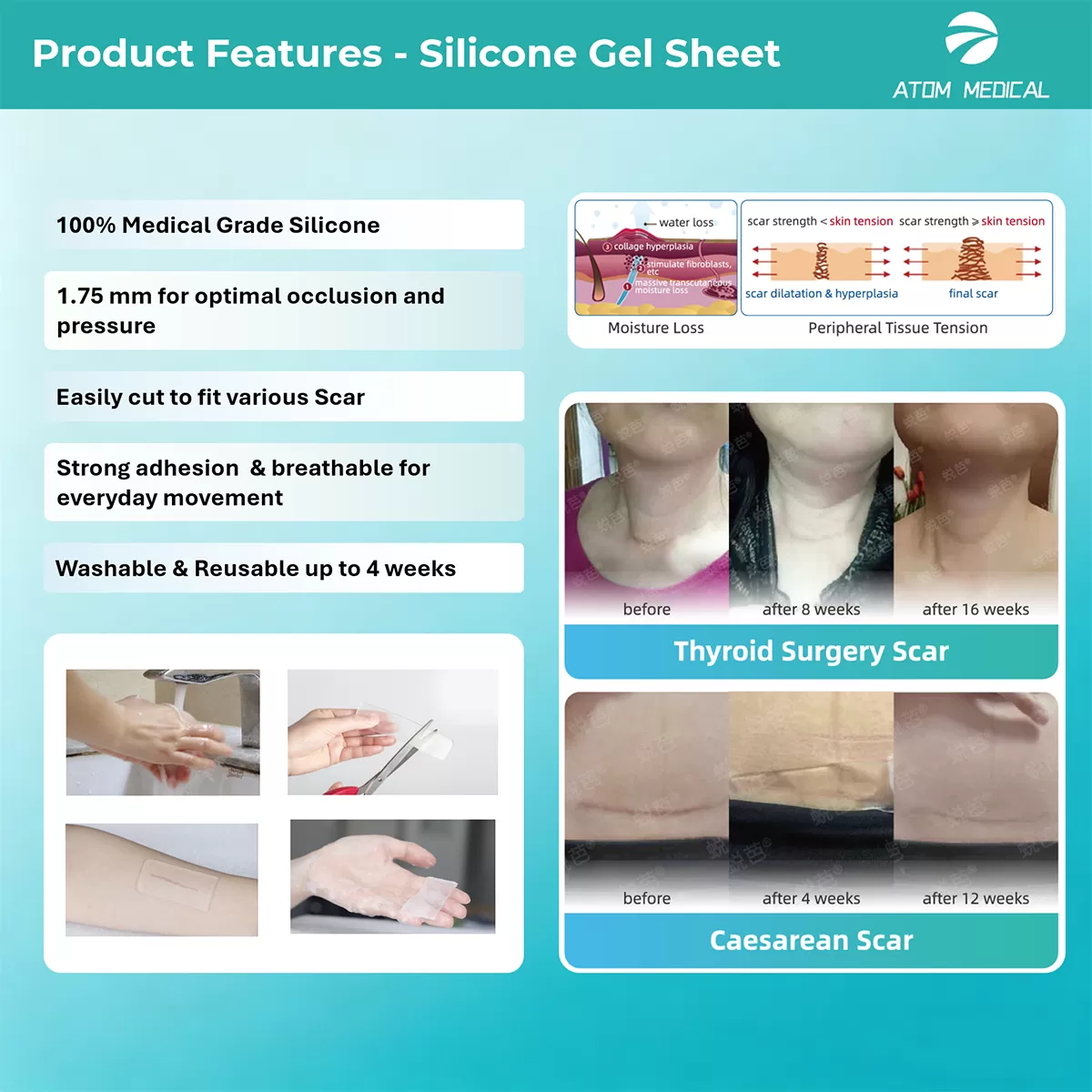 Silicone Gel Sheet
