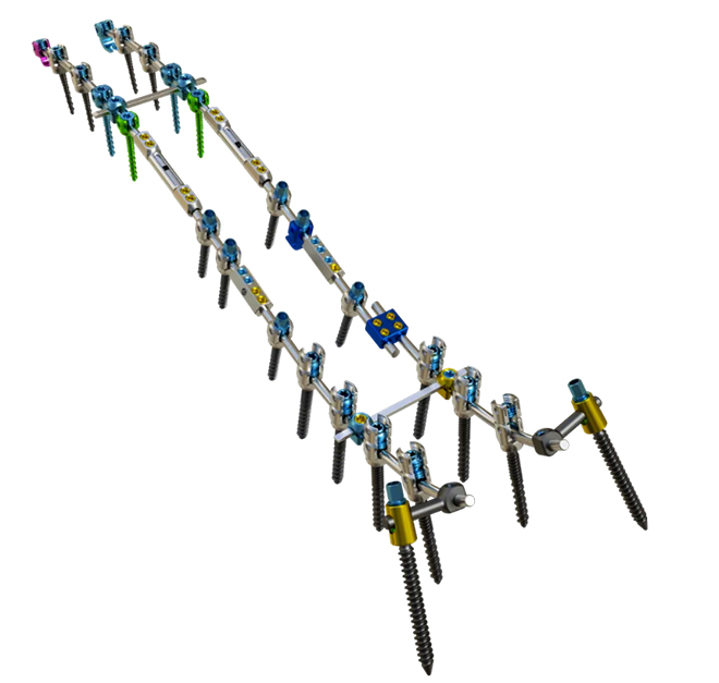 PUMC Classification and Solutions for Idiopathic Scoliosis