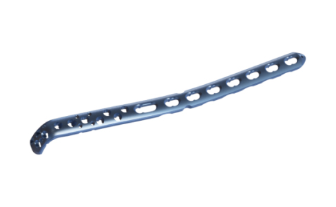 Internal Fixation Techniques for Olecranon Fractures of the Ulna