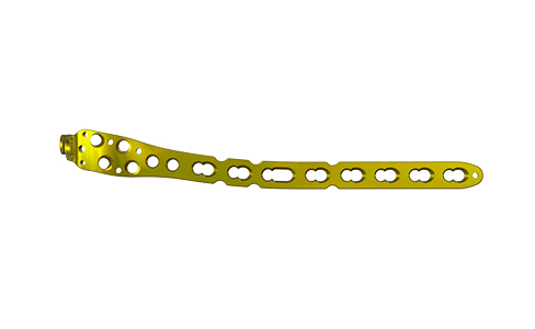 Internal Fixation Techniques for Olecranon Fractures of the Ulna