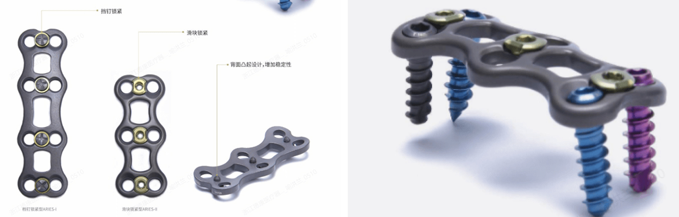 Anterior Cervical Plate Fixation System