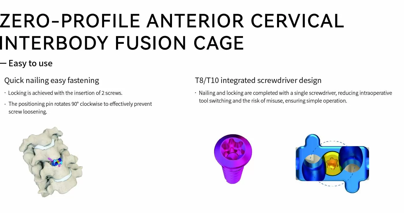 Self-Stabilizing Cervical Interbody Fusion Cage - 2 Screws