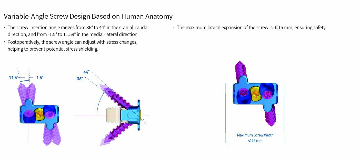 Cervical Interbody Fusion Cage (2 Screws)