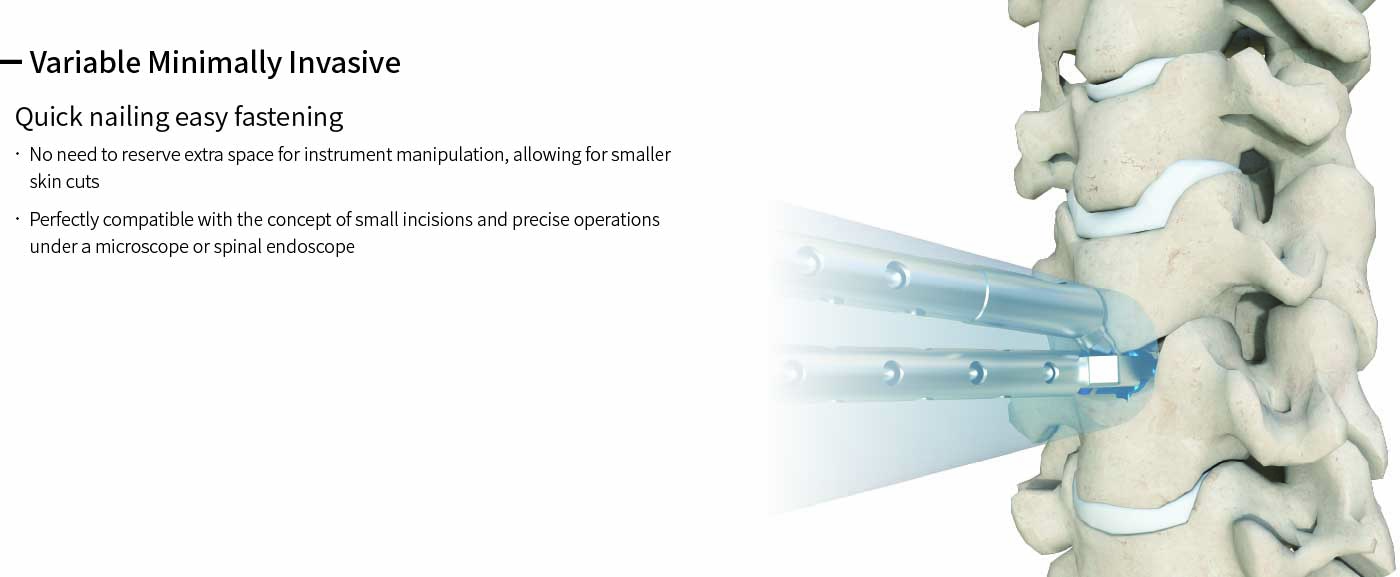 Cervical Interbody Fusion Cage (2 Screws)