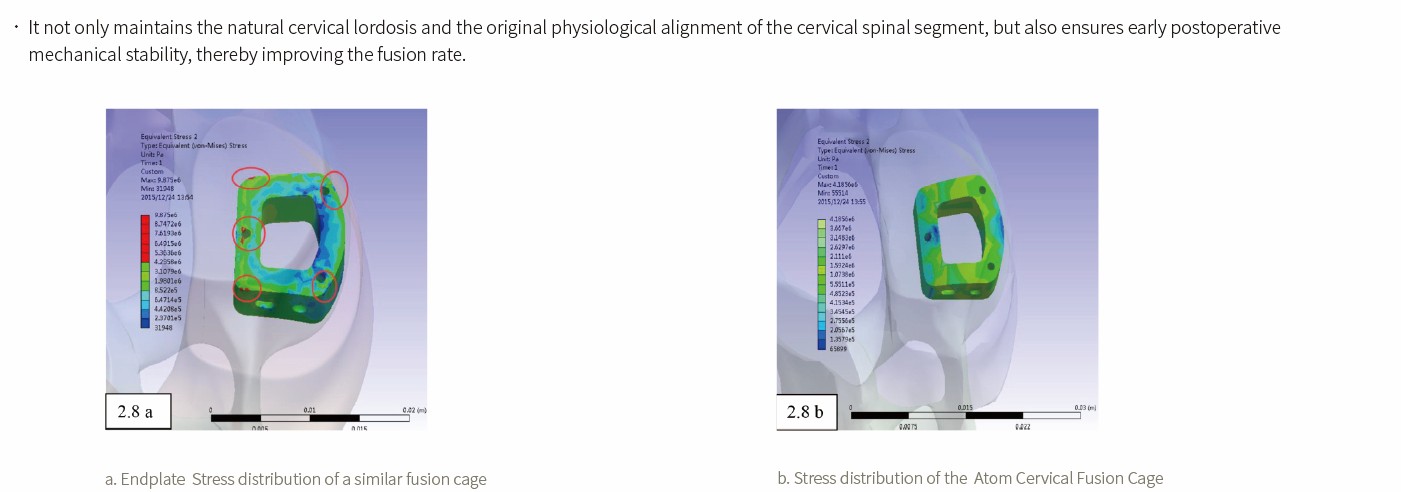 Cervical Interbody Fusion Cage