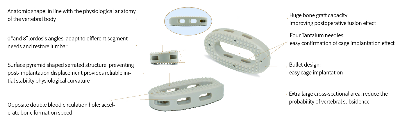 Oblique Lateral Interbody Fusion Cage LF-IV